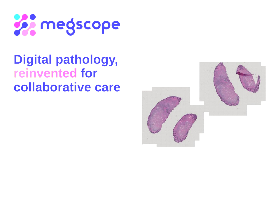 Megscope digital pathology platform